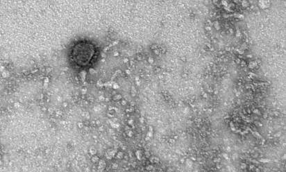 Ето малкото нещо, което причинява COVID-19 (СНИМКИ)