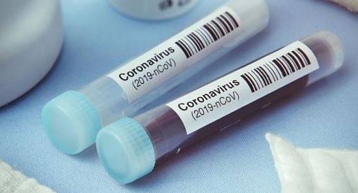 Вирусолог: Има данни за два различни варианта на коронавируса