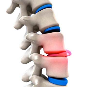 Болка в кръста – видове причини и как да се справим – АЛФАМЕДИКА