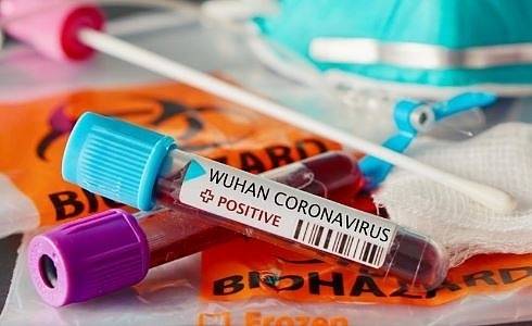 Прокуратурата пита здравния министър за контрола при използването на бързите тестове за COVID-19