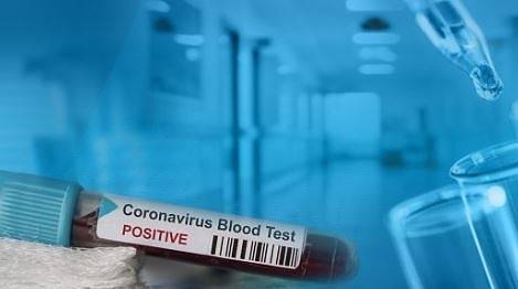 10-та жертва. 40-годишен мъж с COVID-19 почина в „Пирогов“