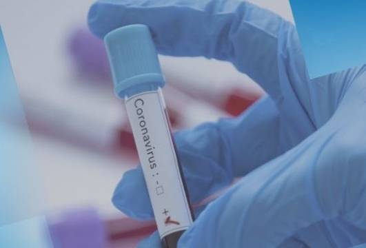 1300 са потвърдените случаи на COVID-19 у нас