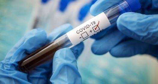 Нова жертва на COVID-19 у нас, заразените станаха 1778