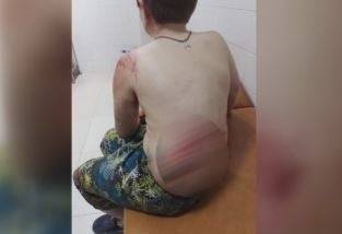 Куче нахапа жестоко 10-годишно дете в град Крън (СНИМКИ)