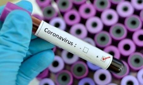 41 нови случая на коронавирус у нас