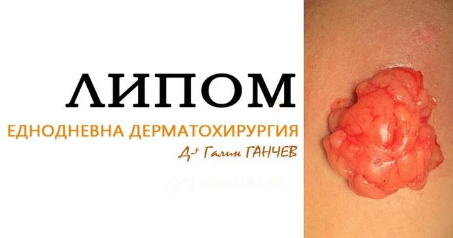 Д-р Галин ГАНЧЕВ – хирург