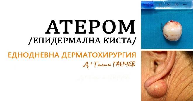 Д-р Галин ГАНЧЕВ – хирург