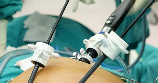 Хигиенно-диетичен режим след лапароскопска холецистектомия или какво трябва да знам след отстраняване на жлъчния мехур. Д-р…