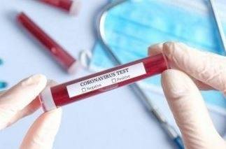 След масовото тестване за COVID-19 в Пловдив: Само 1% имат антитела