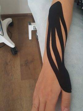 Теносиновит на Де Кервен. Болки в палеца и китката.