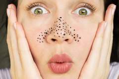 Черните точки – кой е най-добрият начин да се отървете от тях?