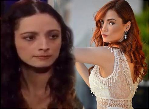 Шениз от Безмилостен град преди пластичните операции и след тях /СНИМКИ/