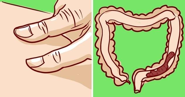 ​Как по естествен път да се справим с проходимостта на червата, без хапчета