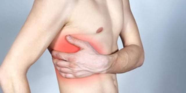 Интеркостална невралгия