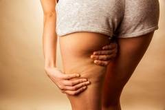 Борбата с целулит – съвети за справяне с този проблем