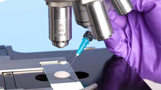 Азооспермия – Диагноза, лечение и шансове за зачеване