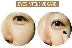 Ползите от пачовете и околоочните продукти за кожата на лицето