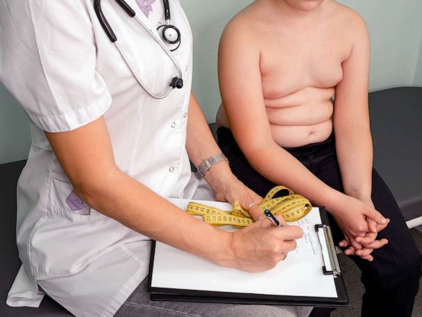 Новости в лечението на детското затлъстяване